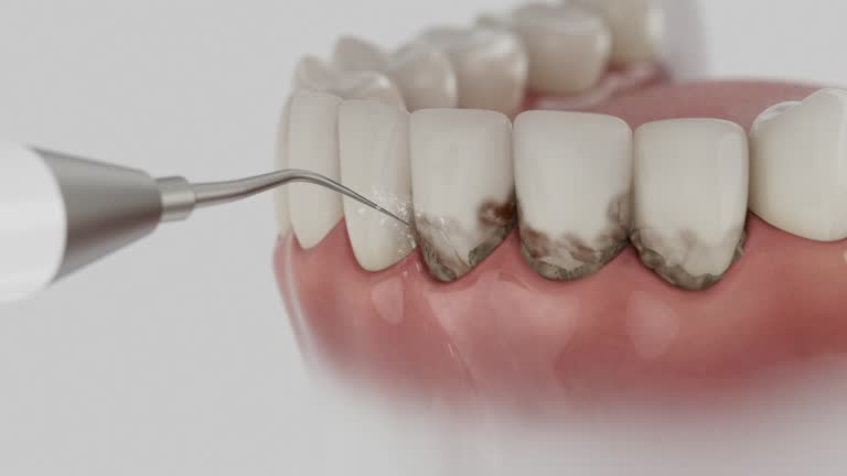 Trusted Root Canal Treatment service in Villa Rica, GA - Dentist Open Now